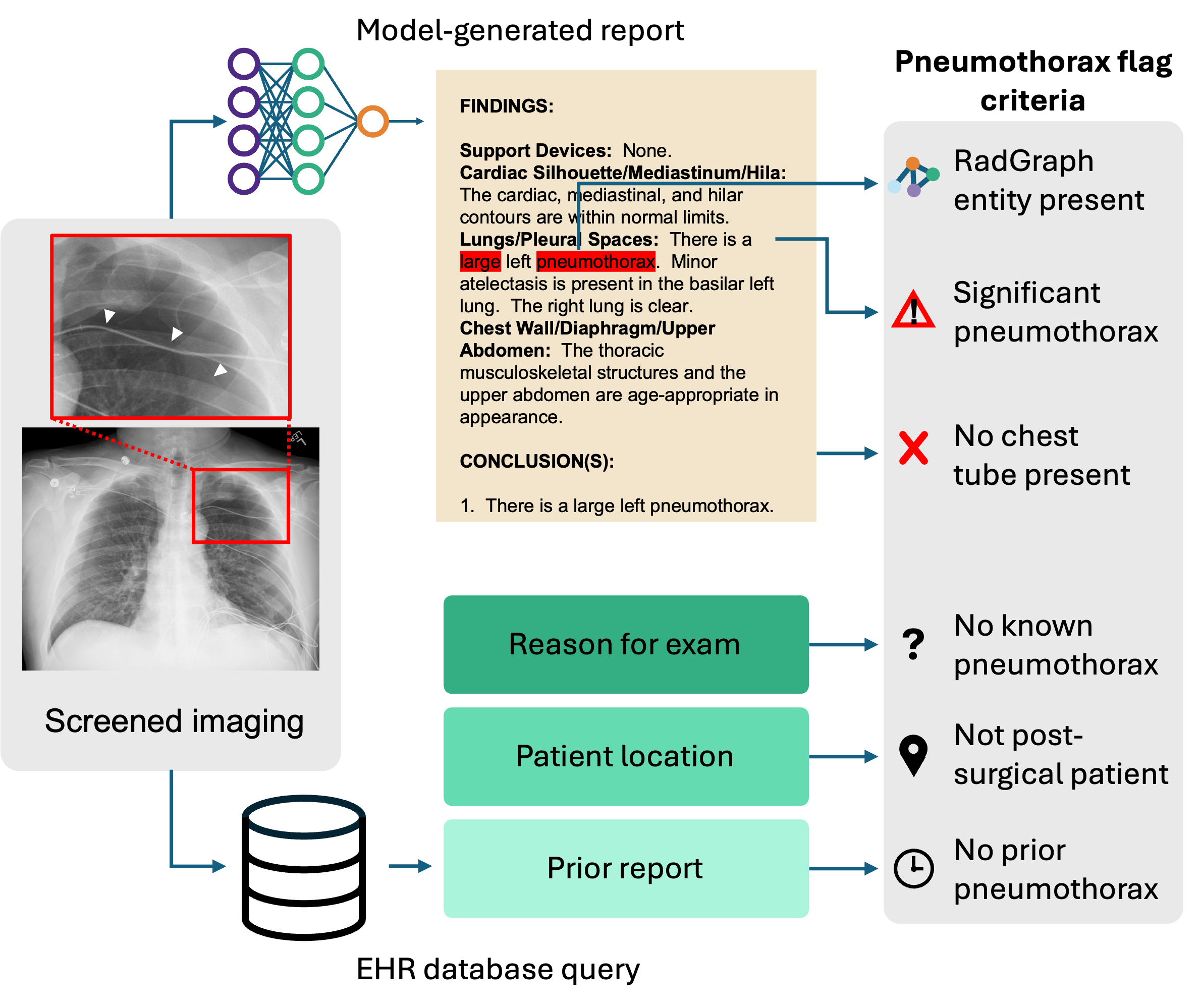 Pneumothorax detection